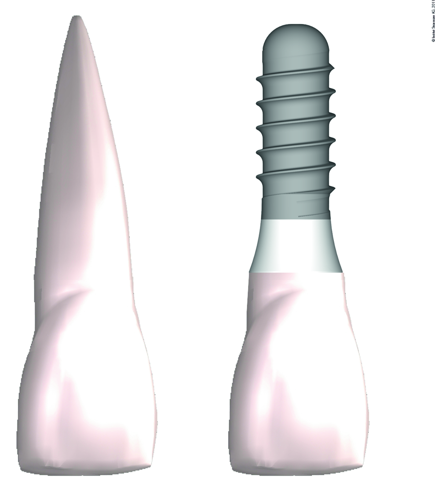 Titan Implantat Zahnwurzel